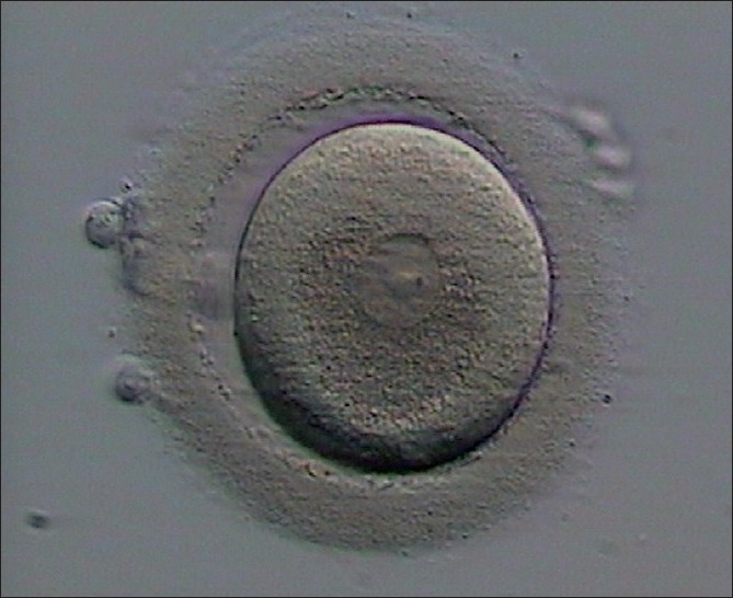 CEL -JHumReprodSci_2010_3_3_153_74161_f2